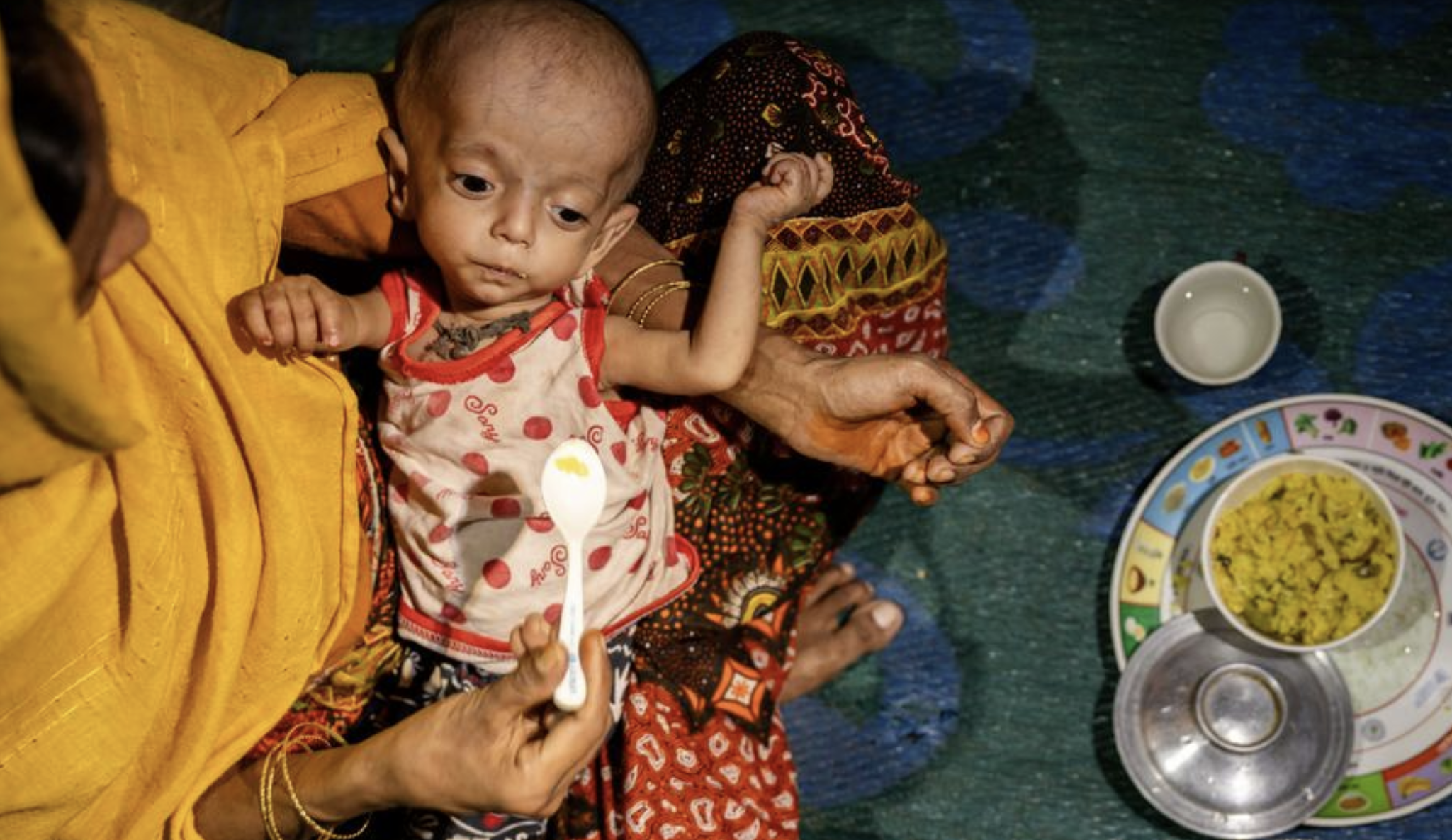 Cox’s Bazar’daki Rohingya mülteci kamplarında ruh sağlığı krizi